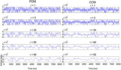 Interactions of BDNF Val66Met Polymorphism and Menstrual Pain on Brain Complexity